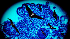 Understanding Nipah Virus and Its Effects on Nigeria